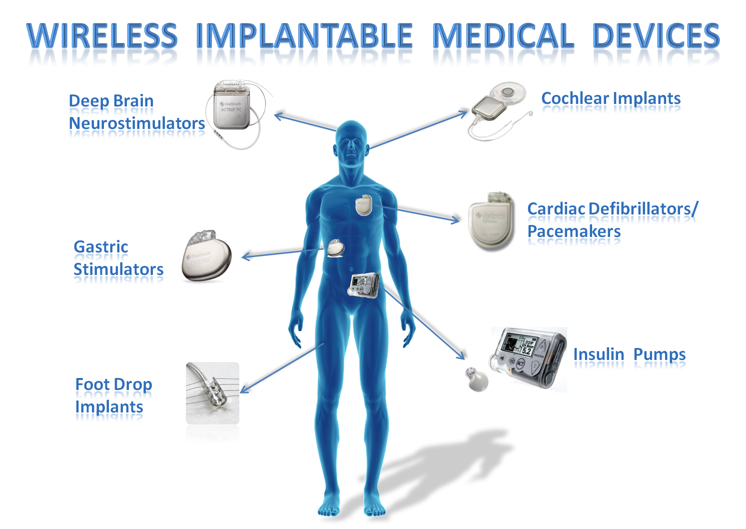 Implantable Medical Devices